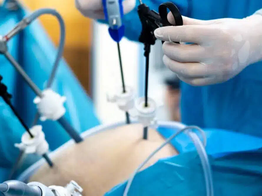 Choose safe, trusted bariatric surgery in Tijuana with Dr. Jorge Castillo. Board-certified care for gastric sleeve and gastric bypass.